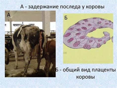 shema amnijske votline in posteljice