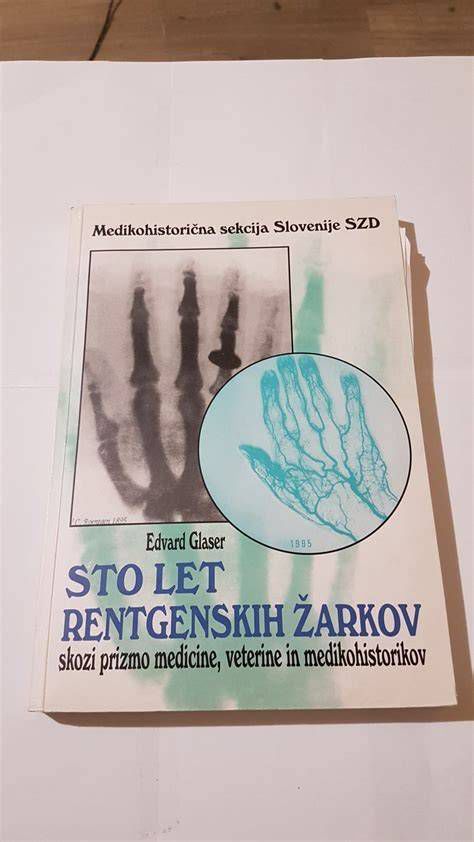 ilustracija vpliva rentgenskih žarkov na plod
