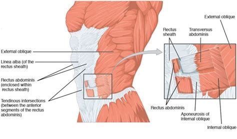 Diagram anatomicne postavitve globoke trebušne mišice in povezanost z diastazo