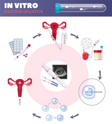 infografika postopka umetne oploditve pri nosorogu (diagnostika, stimulacija, punkcija, oploditev, transfer)