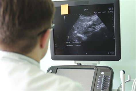 Ultrazvočna diagnostika možganskih žil pri dojenčku