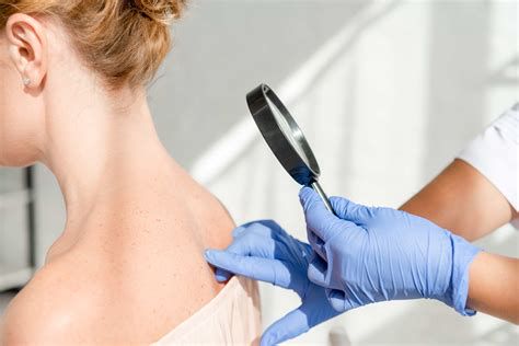 Dermatološki pregled in nega kože med nosečnostjo