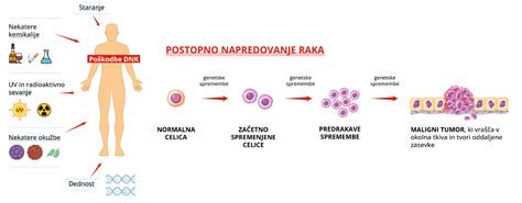 Infografika: Kako bilirubin nastane in kako ga telo izloči
