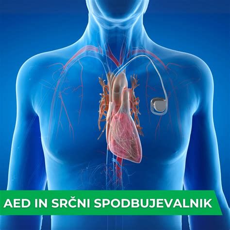 Slika: srčni spodbujevalnik