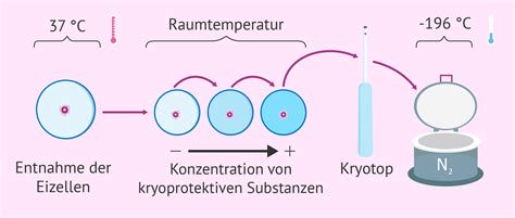 Labor und Kryokonservierung - Samenzellen, Eizellen, Gewebe