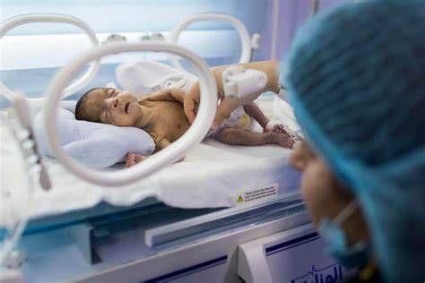 Novorojenček v inkubatorju na oddelku za intenzivno neonatalno nego