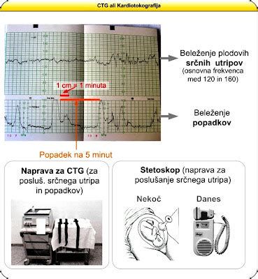 CTG in ultrazvočni pregled v porodnišnici