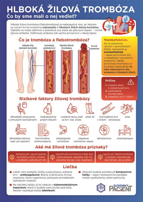 infografika-preprecevanje-hemoroidov-nosecnice