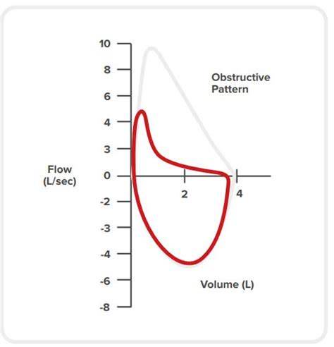 spirometrija-otrok