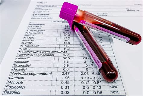 slika: laboratorijski test (vzorčenje krvi za CK) in potek genetskega testiranja