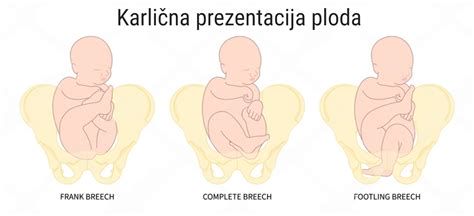 Nočni premiki ploda - ura in umirjena mamica